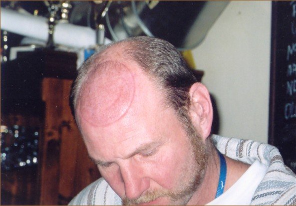 Foto . 52